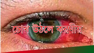 চোখ উঠলে করণীয়